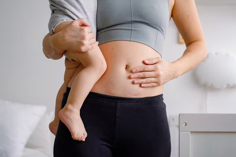 pregnancy weight loss GLP-1