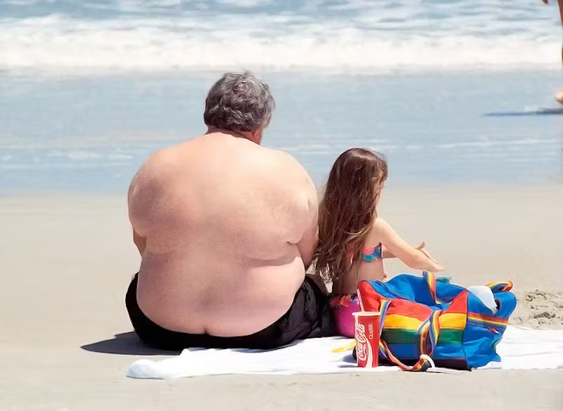 What is obesity