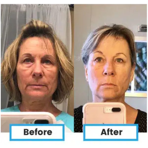 benefits-of-glutathione-89457.png Glutathione Injections: Side Effects & Benefits