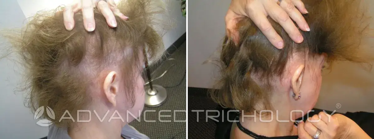 Advanced Trichology1