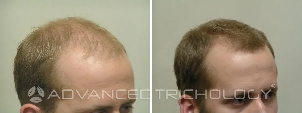 Advanced Trichology12