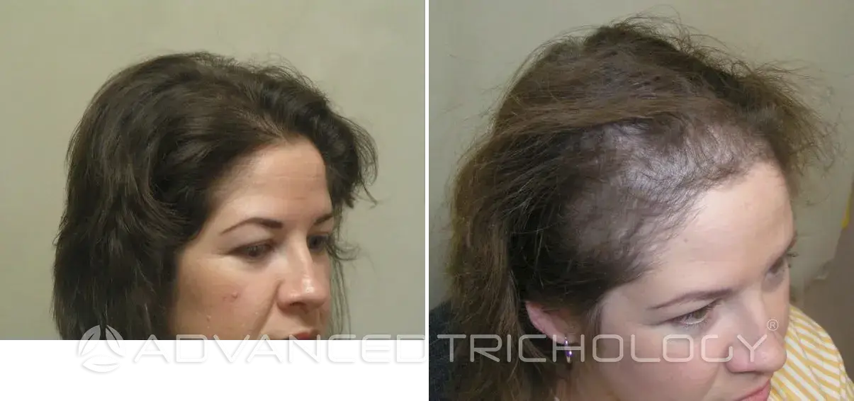Advanced Trichology13