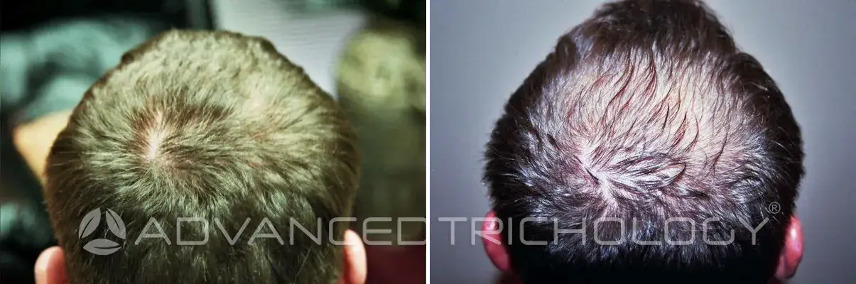 Advanced Trichology14