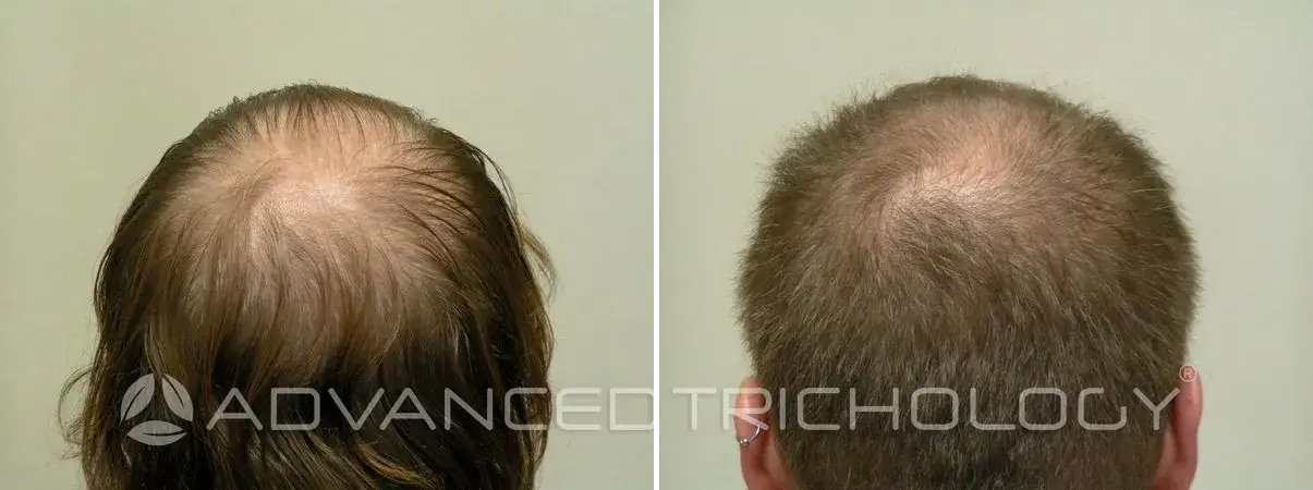 Advanced Trichology15