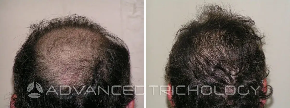 Advanced Trichology16