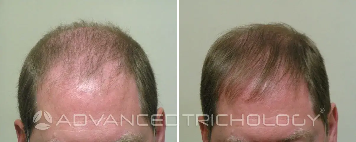 Advanced Trichology17
