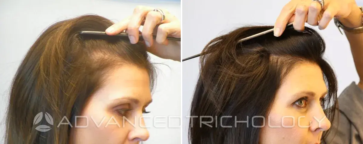 Advanced Trichology2