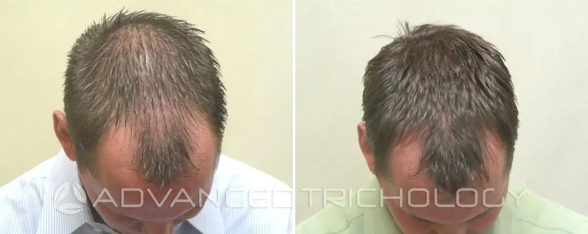 Advanced Trichology20