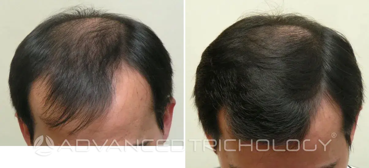 Advanced Trichology21