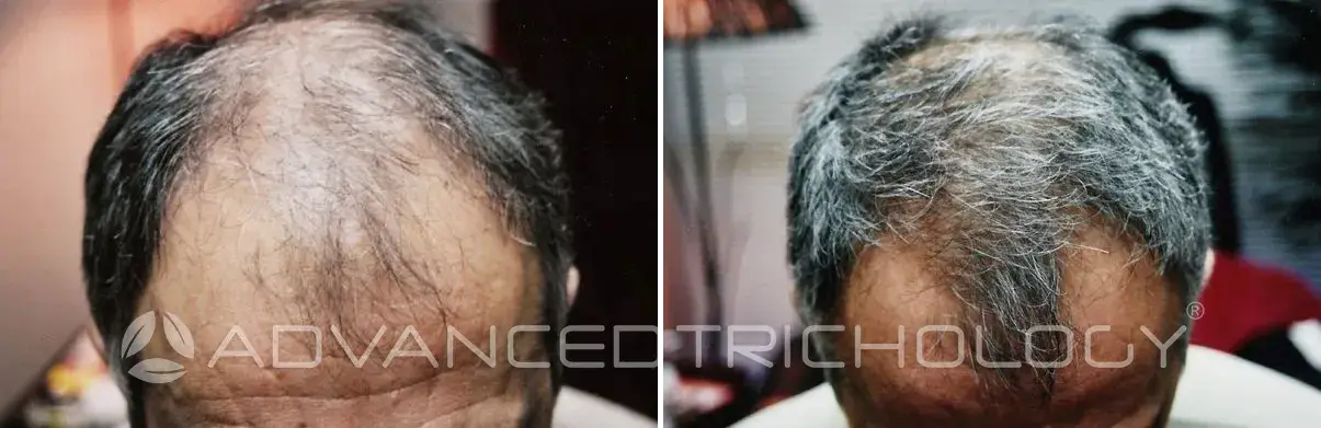 Advanced Trichology24