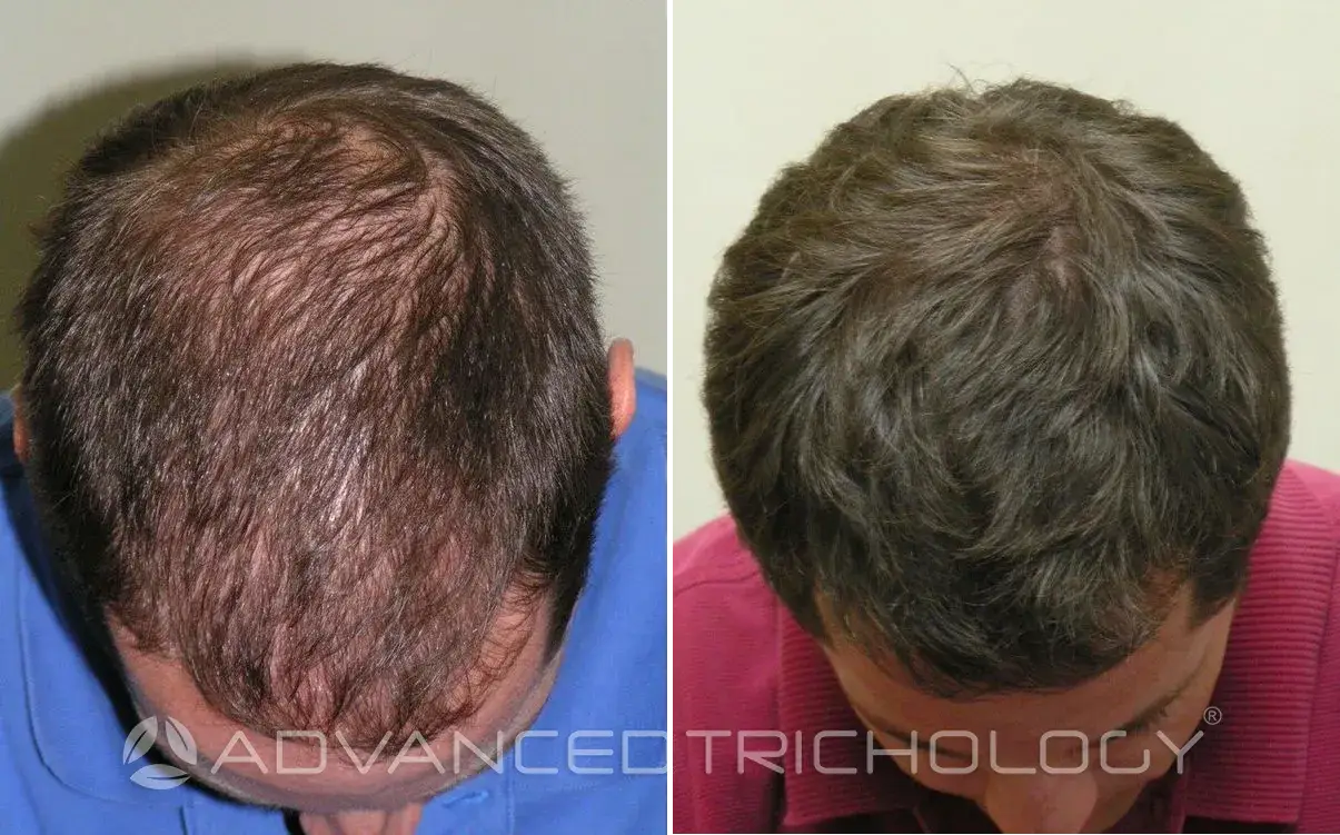 Advanced Trichology26