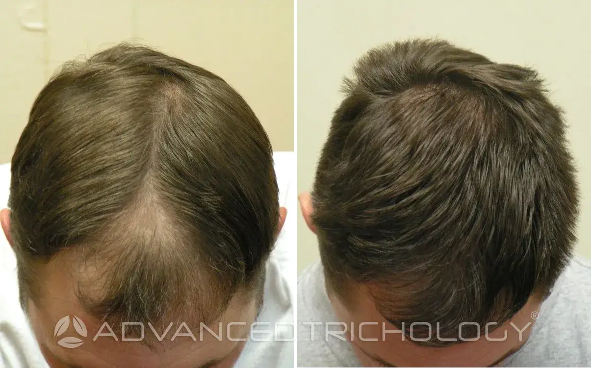 Advanced Trichology29