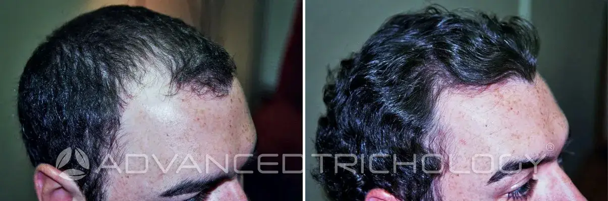 Advanced Trichology7