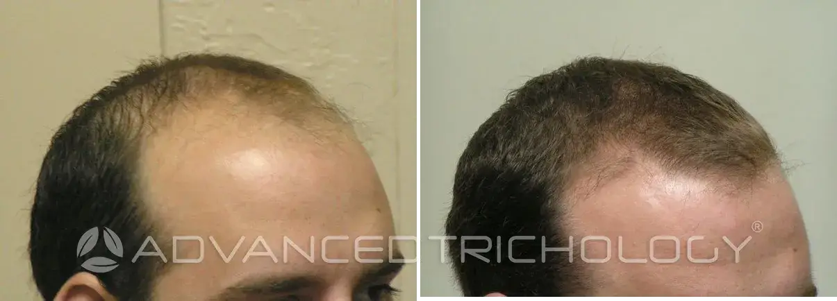 Advanced Trichology8