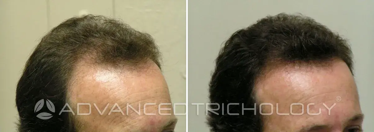Advanced Trichology9