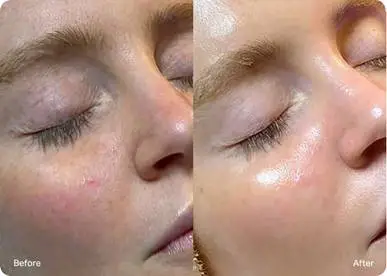 BeforeAfter (2)
