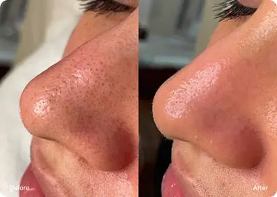 BeforeAfter (3)