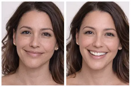 brighter looking skin before and after a professional dermaplaning session