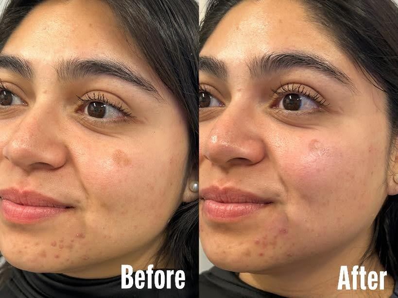Client after a facial treatment with smoother texture and refreshed appearance