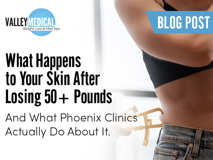 Valley Medical logo; person measuring waist with calipers beside the blog post title about skin after losing 50+ pounds.