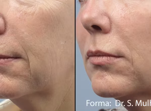 1677094849-forma-before-after-dr-s-mulholland-preview-1