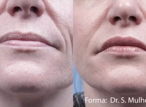 1677094876-forma-before-after-dr-s-mulholland-preview-2